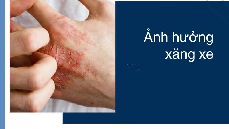 Tác hại của xăng xe trong sinh hoạt hàng ngày
