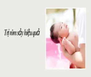 Mẹo dân gian trị rôm sảy cho bé an toàn, hiệu quả nhanh chóng