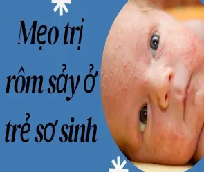 Mẹo trị rôm sảy ở trẻ sơ sinh giúp bé thoải mái, dễ chịu