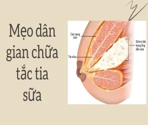 Mẹo dân gian chữa tắc tia sữa tránh đau nhức kéo dài